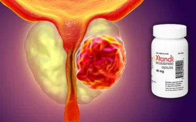 Un fármaco mostró mejoras significativas contra el cáncer de próstata