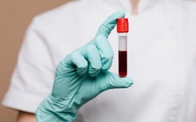 Revelan que un análisis rápido de sangre puede mejorar el tratamiento del ACV