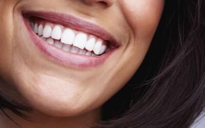 La importancia de sonreír