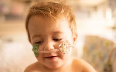 Médicos argentinos avanzaron en la cura de la «piel de cristal»