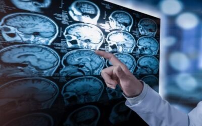 Descifran las capas de los tumores cerebrales