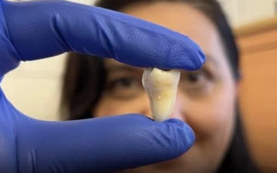 Lo que se viene: dientes cultivados a medida