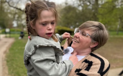 Nació con el corazón afuera del pecho y una cirugía innovadora le salvó la vida