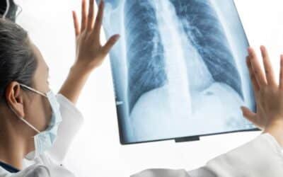 Gran avance en la lucha contra el cáncer de pulmón