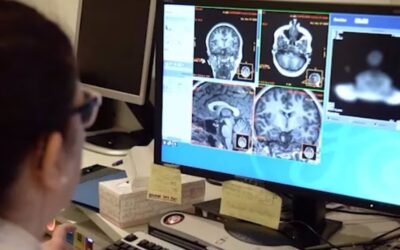 Con una gota de sangre se puede medir el avance del Alzheimer